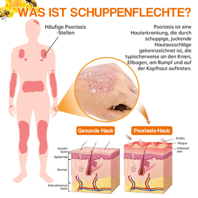 1+1 GRATIS | BeruhigungsSpray™ Lindert trockene Flecken