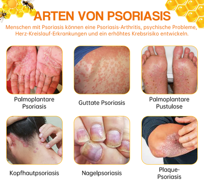1+1 GRATIS | BeruhigungsSpray™ Lindert trockene Flecken