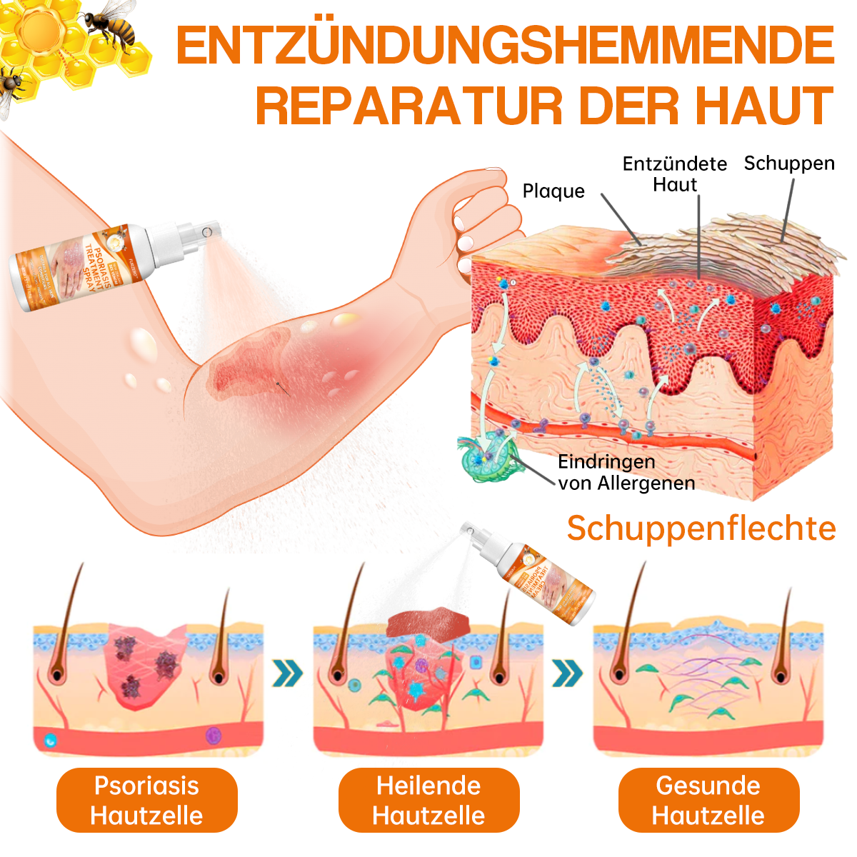 1+1 GRATIS | BeruhigungsSpray™ Lindert trockene Flecken