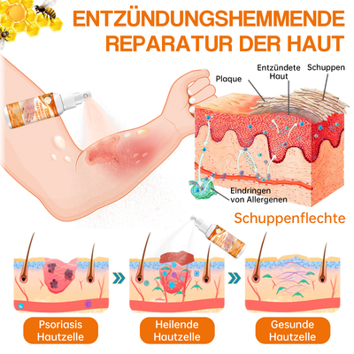 1+1 GRATIS | BeruhigungsSpray™ Lindert trockene Flecken