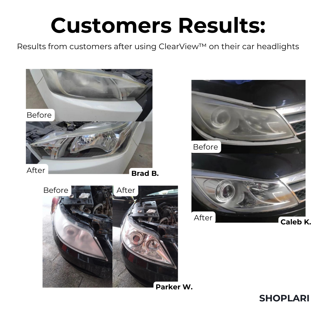 ClearView™ Scheinwerfer-Reparaturflüssigkeit I Letzter Tag 1+1 GRATIS🔥