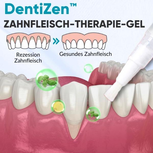 DentiZen™ Therapie-Gel für gesundes Zahnfleisch