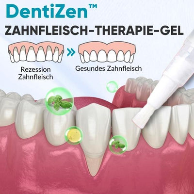 DentiZen™ Therapie-Gel für gesundes Zahnfleisch