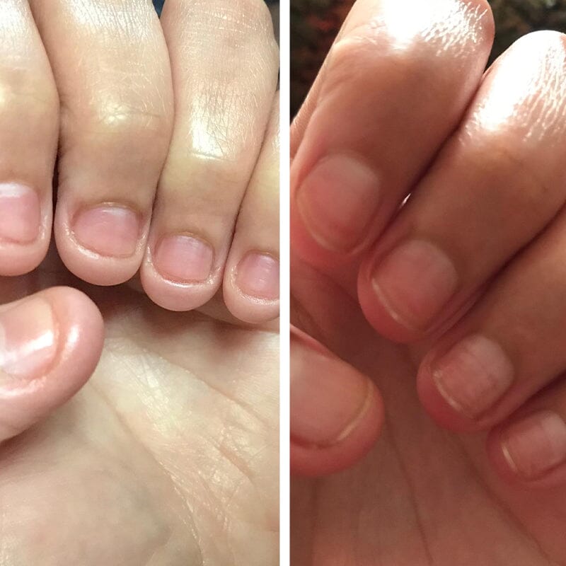 NagelElixier™ Revitalisierende Nagelbehandlung