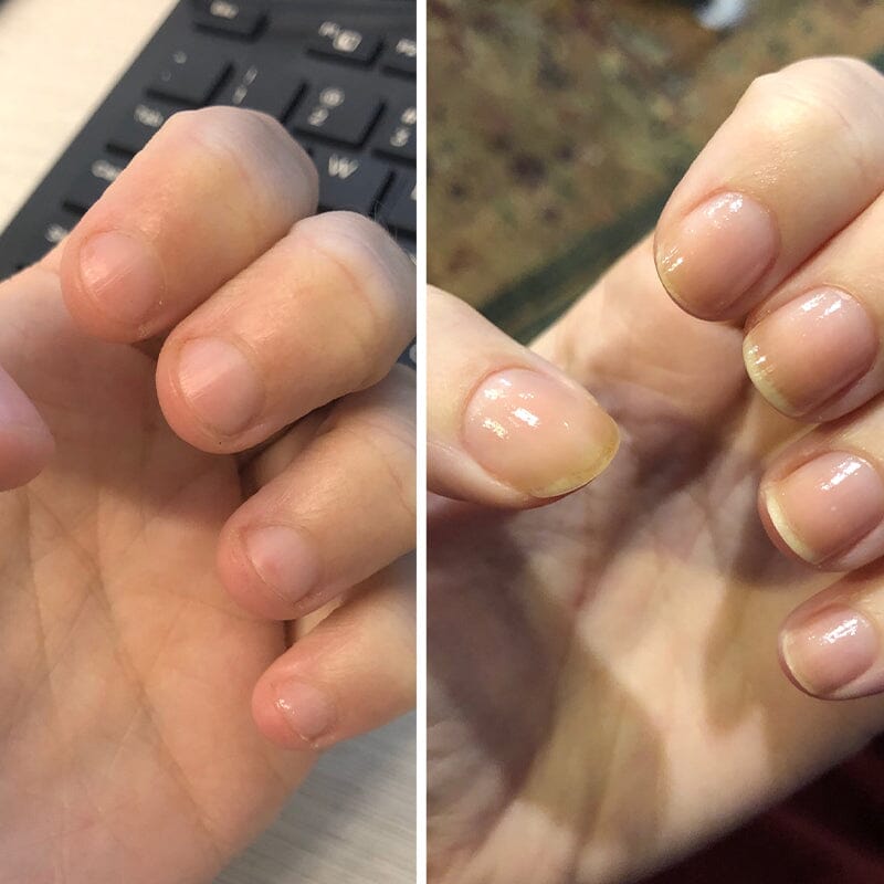 NagelElixier™ Revitalisierende Nagelbehandlung