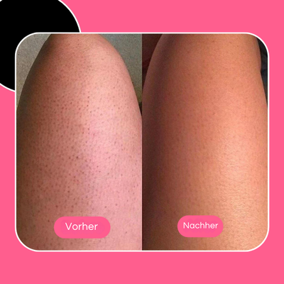 Wolkenbürste™ Ultrasanftes Peeling
