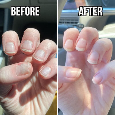 NagelElixier™ Revitalisierende Nagelbehandlung