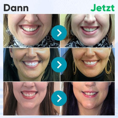 DentiZen™ Therapie-Gel für gesundes Zahnfleisch