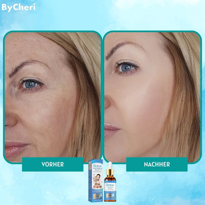 GlowTight™ Botox-ähnliches Anti-Aging-Lifting-Serum (1+1 GRATIS)