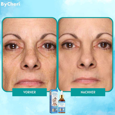GlowTight™ Botox-ähnliches Anti-Aging-Lifting-Serum (1+1 GRATIS)