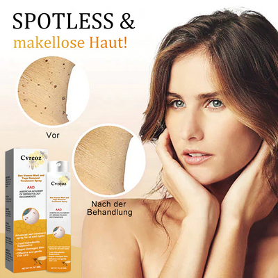 1+1 Gratis | Skin Free™ l Alle Flecken, Muttermale und Warzen werden innerhalb von 3 Tagen um 90% beseitigt!