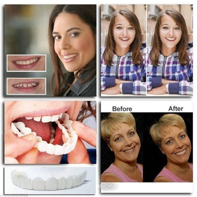 SchnellesEinrasten™ Einstellbare Schnappprothese