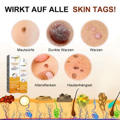 1+1 Gratis | Skin Free™ l Alle Flecken, Muttermale und Warzen werden innerhalb von 3 Tagen um 90% beseitigt!
