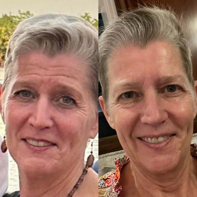 Wiederverwendbare Anti-Falten-Patches | Schlafpads für Gesicht & Stirn | Glättet Linien & Falten über Nacht