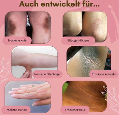 1+1 Gratis | Medizinische Fußpflegecreme | Gegen Pilz, Ekzeme & rissige Haut | Regenerierend, feuchtigkeitsspendend & mit Arnika