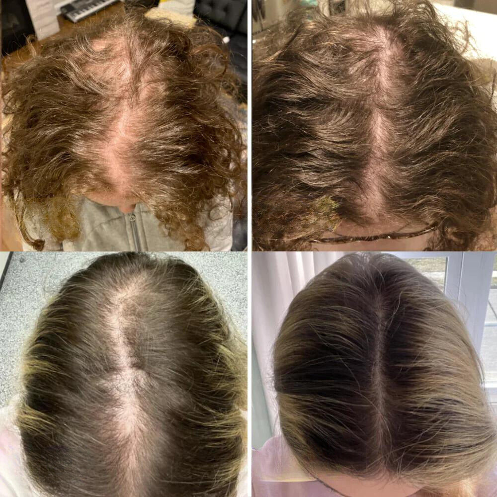 VitalesWachstum™ Haarwuchs-Öl