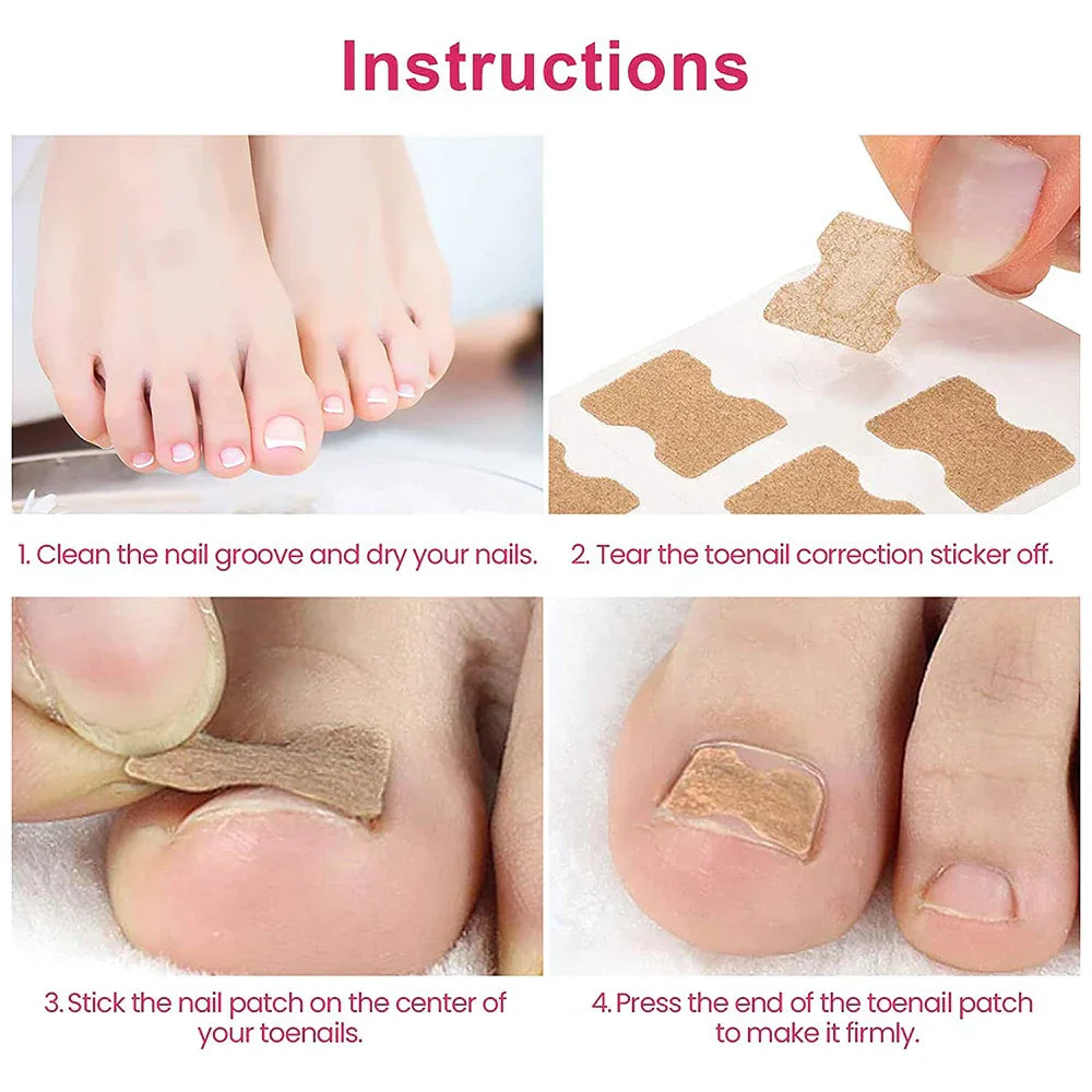 NägelNachbessern™ Pflegeaufkleber für Nagelkorrekturen