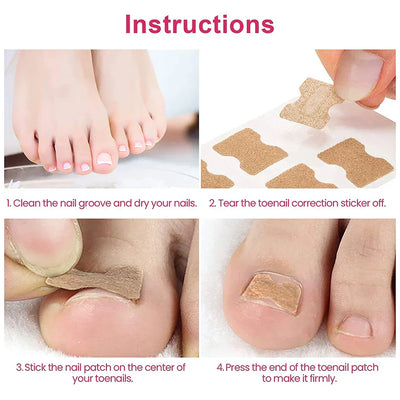 NägelNachbessern™ Pflegeaufkleber für Nagelkorrekturen