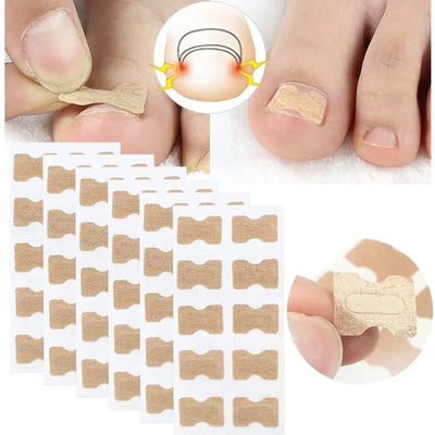 NägelNachbessern™ Pflegeaufkleber für Nagelkorrekturen