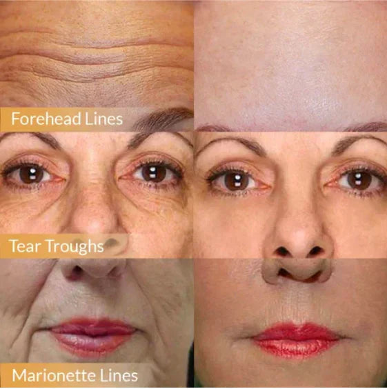 Anti-Aging Gesichtscreme | Japanische Pflege mit Orchideen-Extrakt & Ginseng | Lifting & Feuchtigkeit