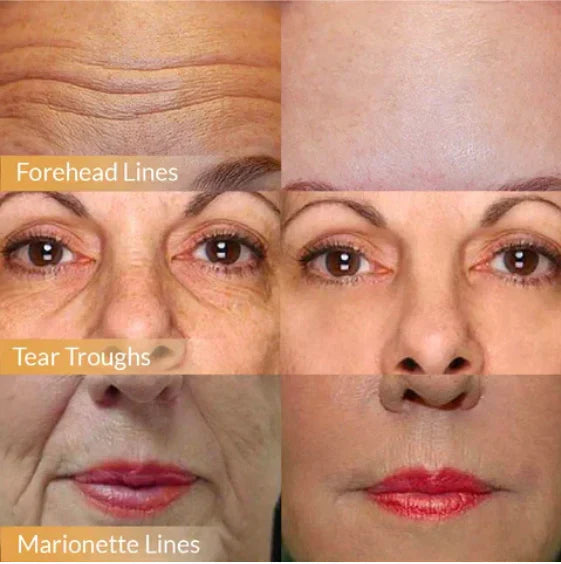 Polypeptid Straffende Gesichtscreme | Mit Schwarzer Orchidee, Granatapfel & Ginseng | Tiefenpflege & Strahlende Haut