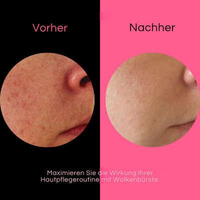 Wolkenbürste™ Ultrasanftes Peeling