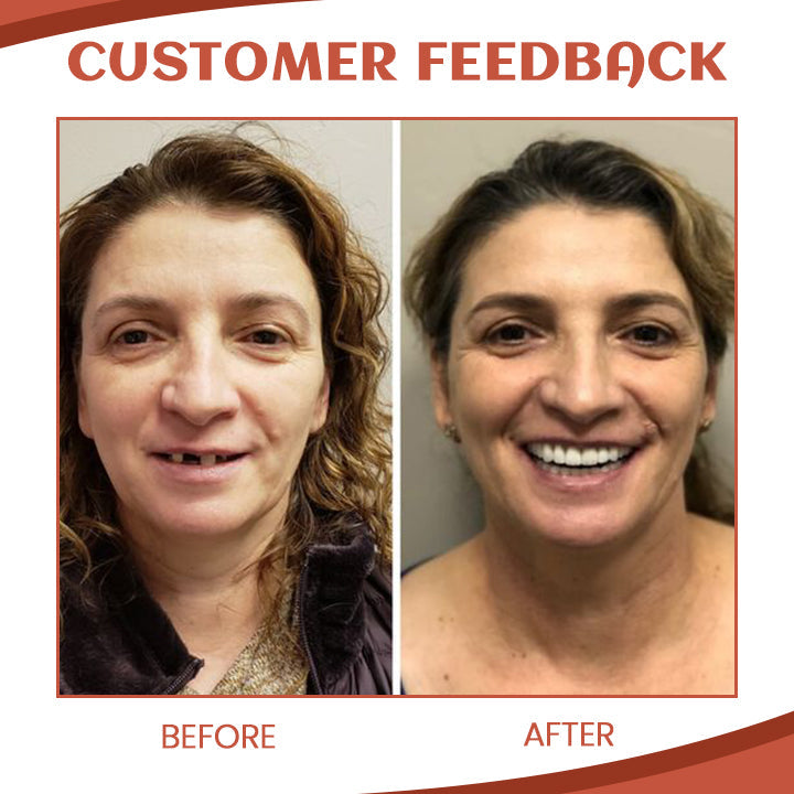 GebissSet™ Prothese Silikon Reline Kit