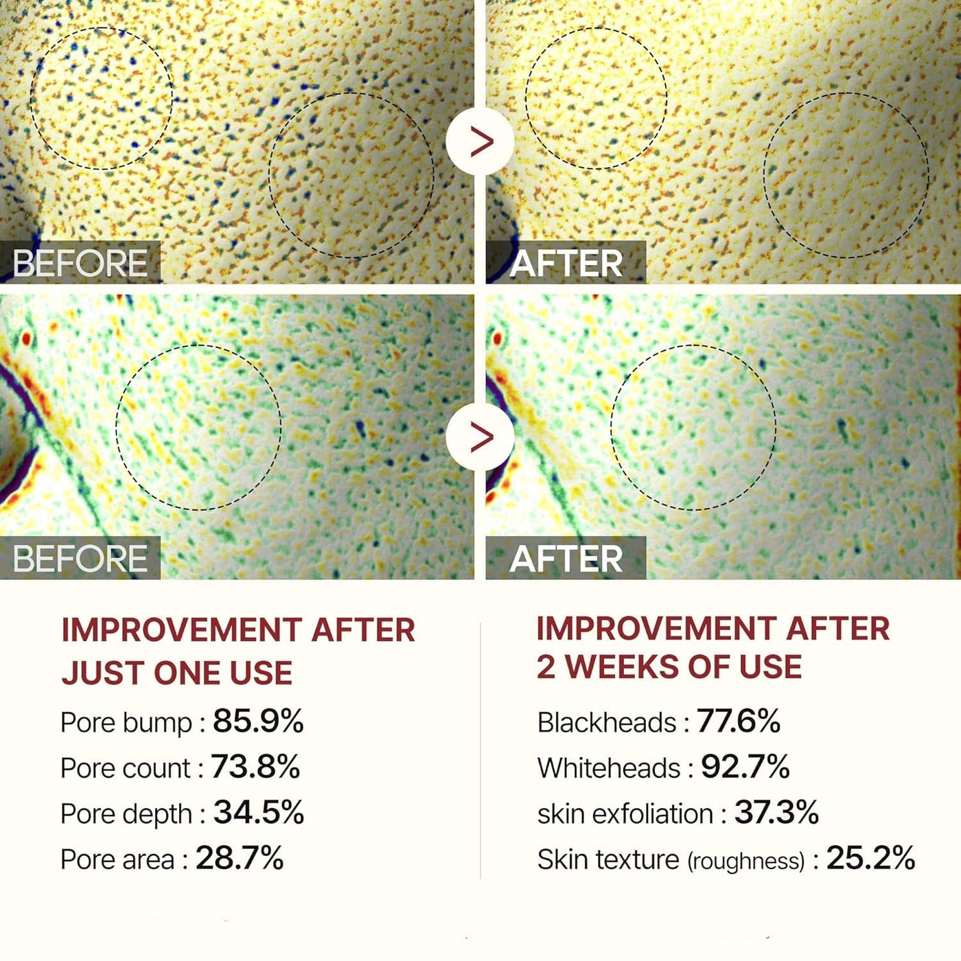 Gesichtspeeling mit Reisextrakt | Sanfte Reinigung ohne Reizungen | Entfernt Ablagerungen sofort