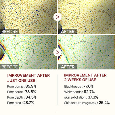 Gesichtspeeling mit Reisextrakt | Sanfte Reinigung ohne Reizungen | Entfernt Ablagerungen sofort