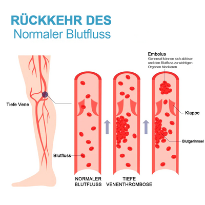FlexSocken™ Ionic Body Stretch Socken (1+2 frei)