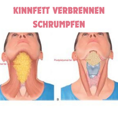 GesichtForm™ Definierende Kieferlinie Optimierung