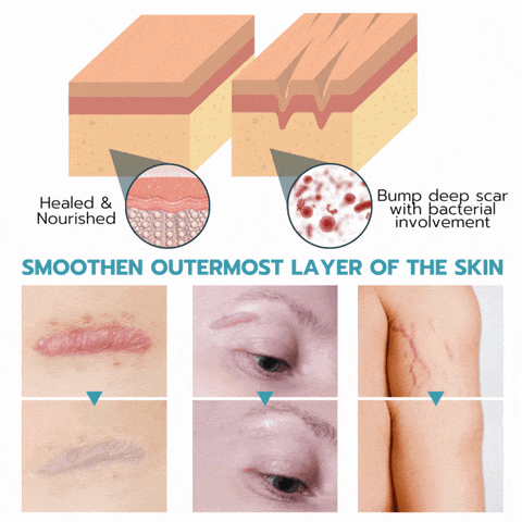 Wiederverwendbare Anti-Falten-Patches | Schlafpads für Gesicht & Stirn | Glättet Linien & Falten über Nacht