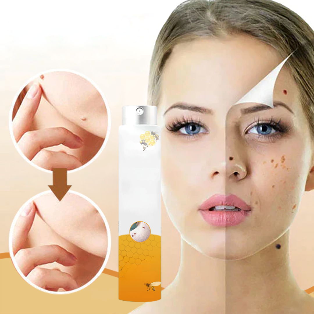 1+1 Gratis | Skin Free™ l Alle Flecken, Muttermale und Warzen werden innerhalb von 3 Tagen um 90% beseitigt!