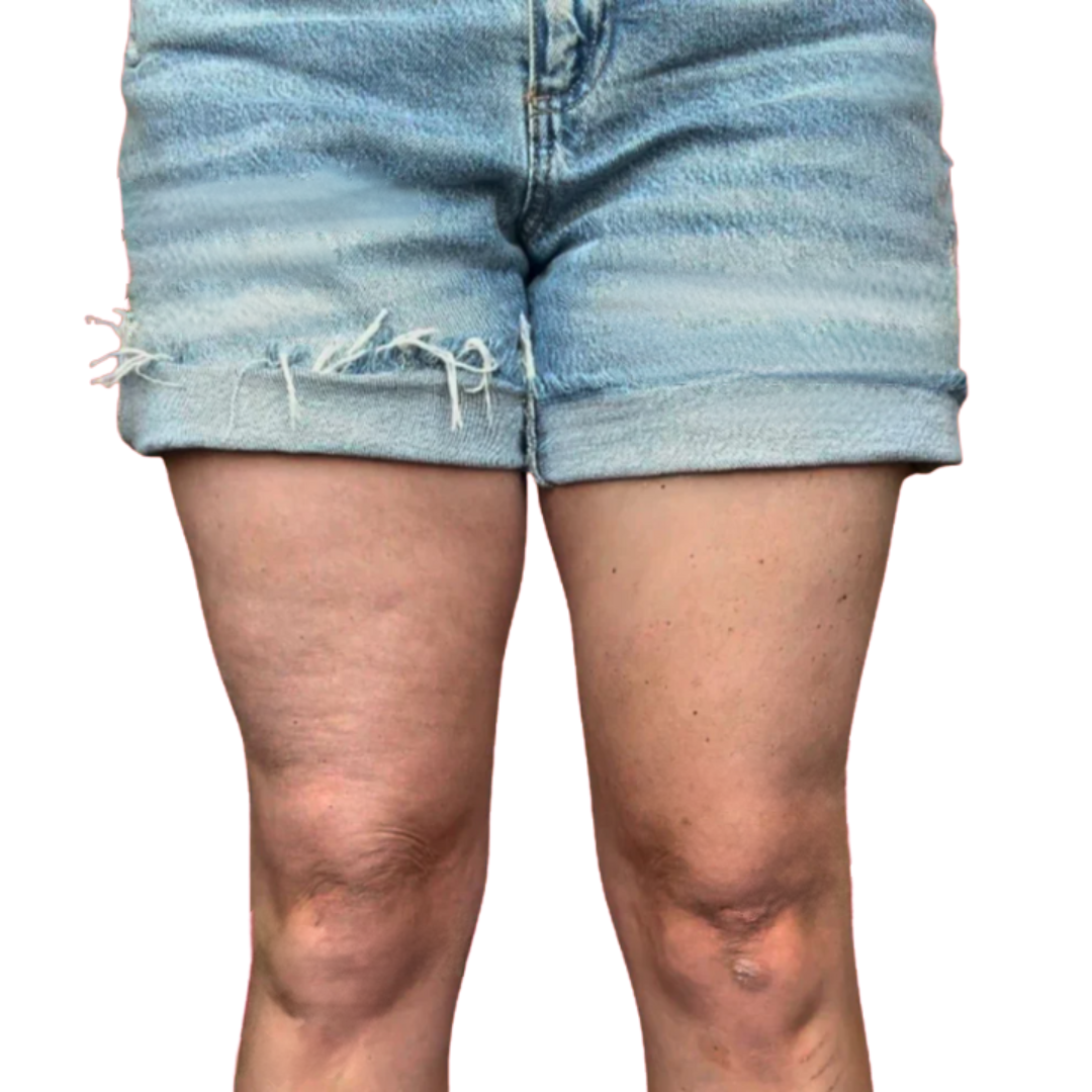 HautStraff™ Nahtlose Festigkeitskontrolle