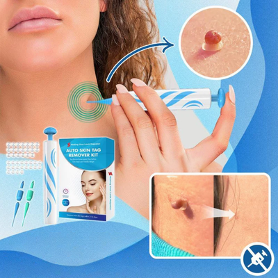 WarzenReinigen™ | Hautpflege-Set zur Entfernung von Hautunreinheiten & Warzen | Schonend & Einfach