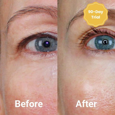 DermaFaden™ Vollständiges Kollagen-Fadenlifting-Kit