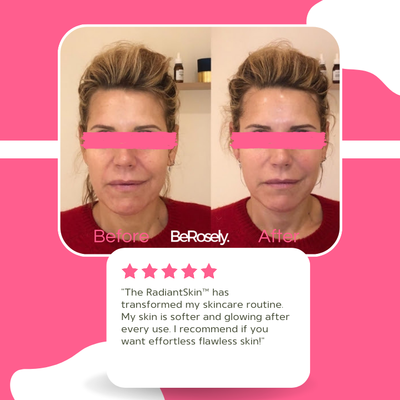 Wolkenbürste™ Ultrasanftes Peeling