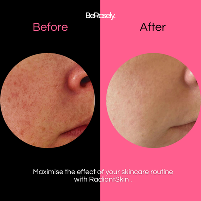 Wolkenbürste™ Ultrasanftes Peeling