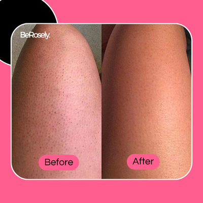 Wolkenbürste™ Ultrasanftes Peeling