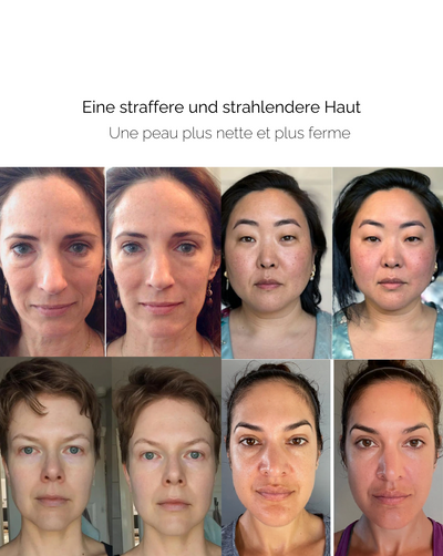 GlanzRolle™ Sanfte Hauterneuerung