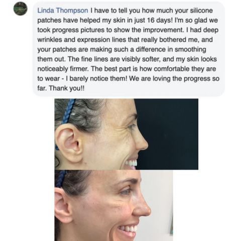 Wiederverwendbare Anti-Falten-Patches | Schlafpads für Gesicht & Stirn | Glättet Linien & Falten über Nacht