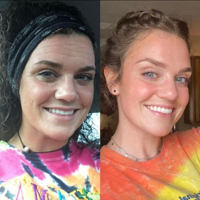 Wiederverwendbare Anti-Falten-Patches | Schlafpads für Gesicht & Stirn | Glättet Linien & Falten über Nacht