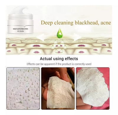 1+1 Gratis | Porenreinigungspflaster | Mitesserentferner mit Aktivkohle & Aloe Vera