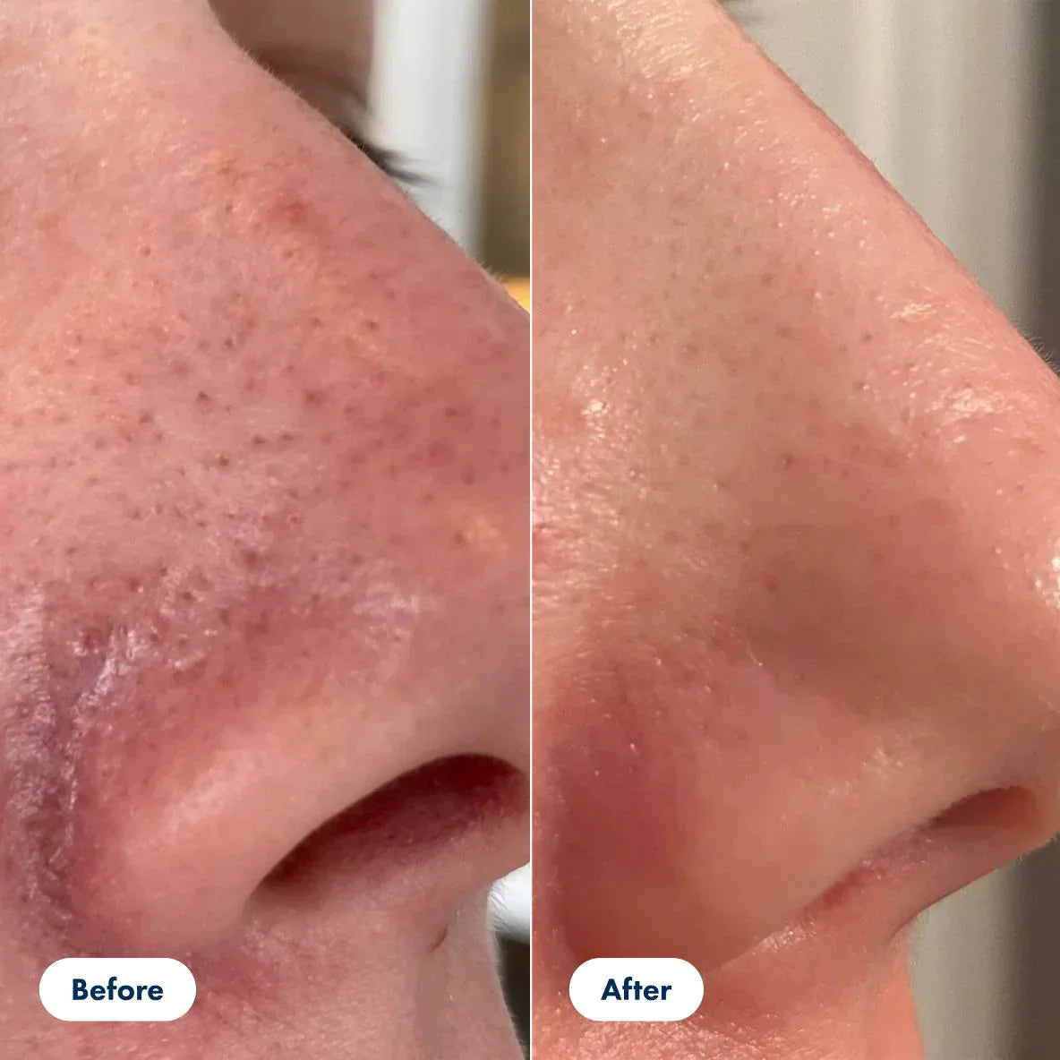 Gesichtspeeling mit Reisextrakt | Sanfte Reinigung ohne Reizungen | Entfernt Ablagerungen sofort