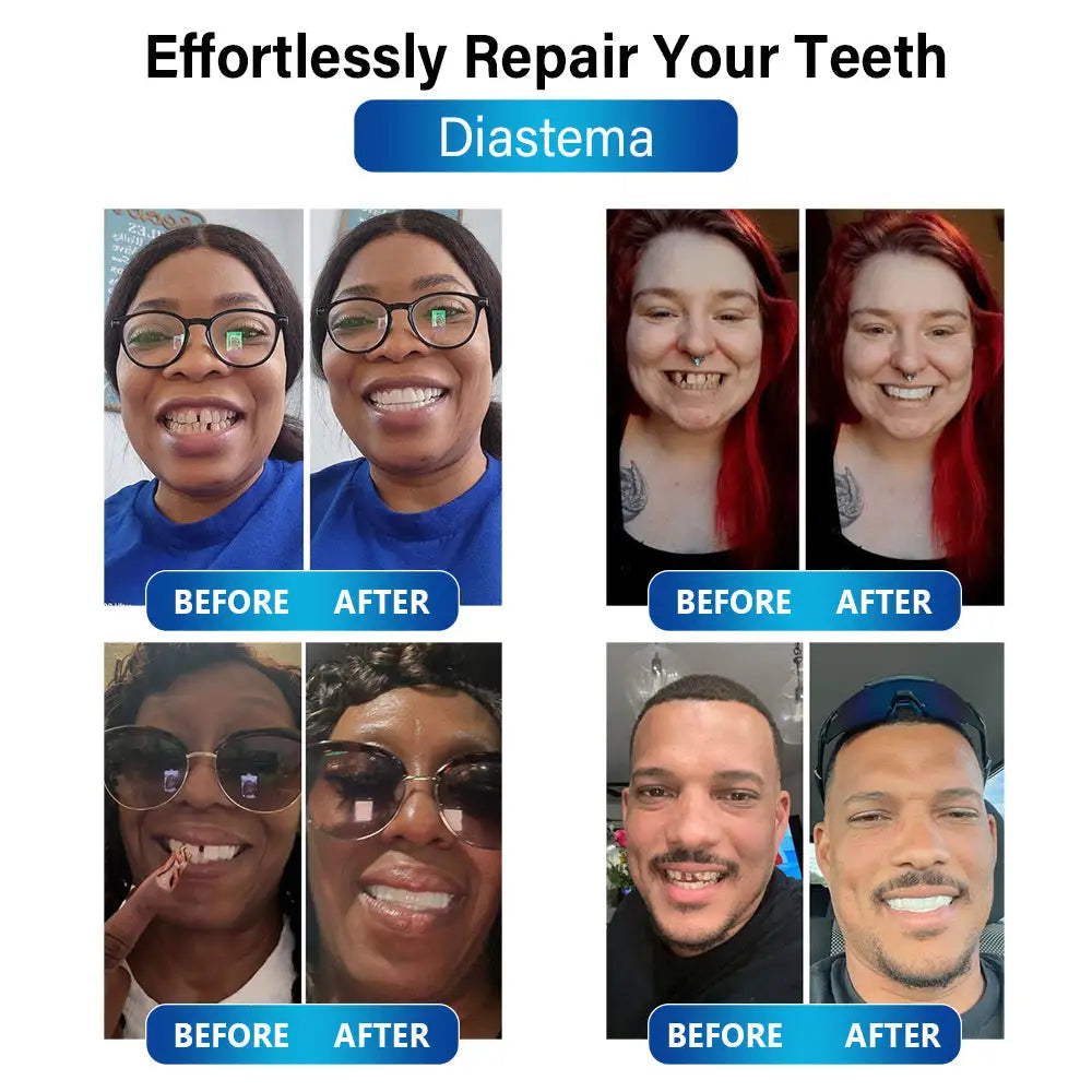 Futusly™ - Blau-Licht Aushärtungsgerät und Zahnprothesenmaterialien