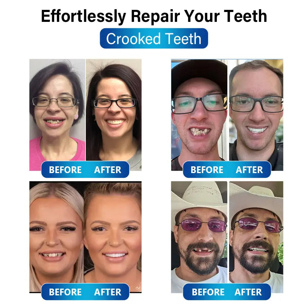 Futusly™ - Blau-Licht Aushärtungsgerät und Zahnprothesenmaterialien