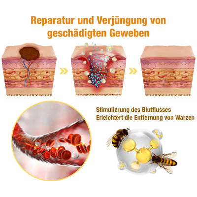 1+1 GRATIS | DermiClear™ - Bienenharzspray zur Entfernung von Warzen und Muttermalen