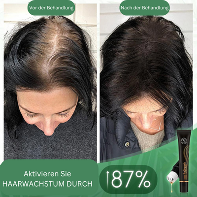HaarBoost™ Bio-Haar-Serum-Roller (1+1 gratis)