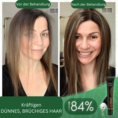 HaarBoost™ Bio-Haar-Serum-Roller (1+1 gratis)