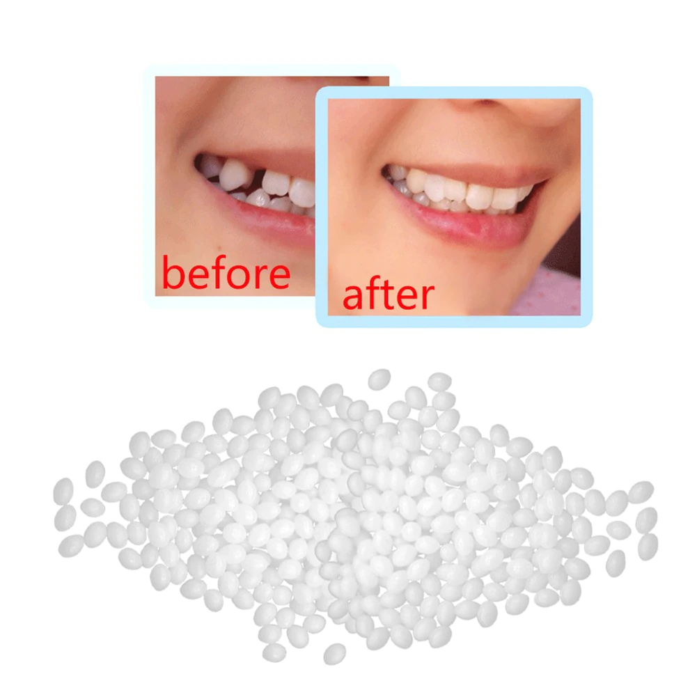 ZahnFix™ DIY Zahnreparaturset